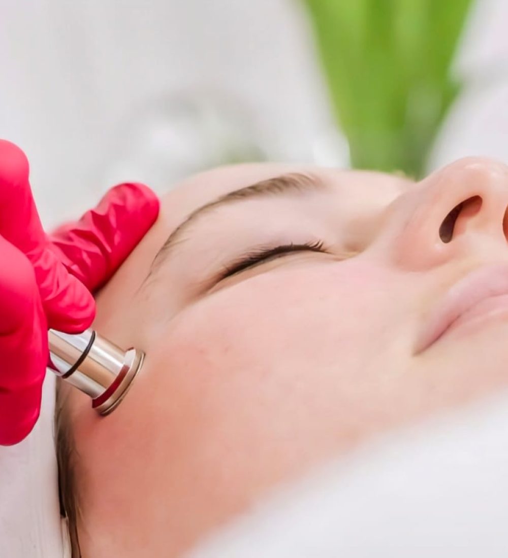 microdermabrasion treatment